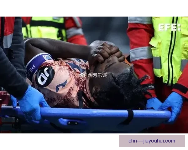 卡瓦哈尔声援罗德里支持球员罢工言论后不幸遭遇重伤